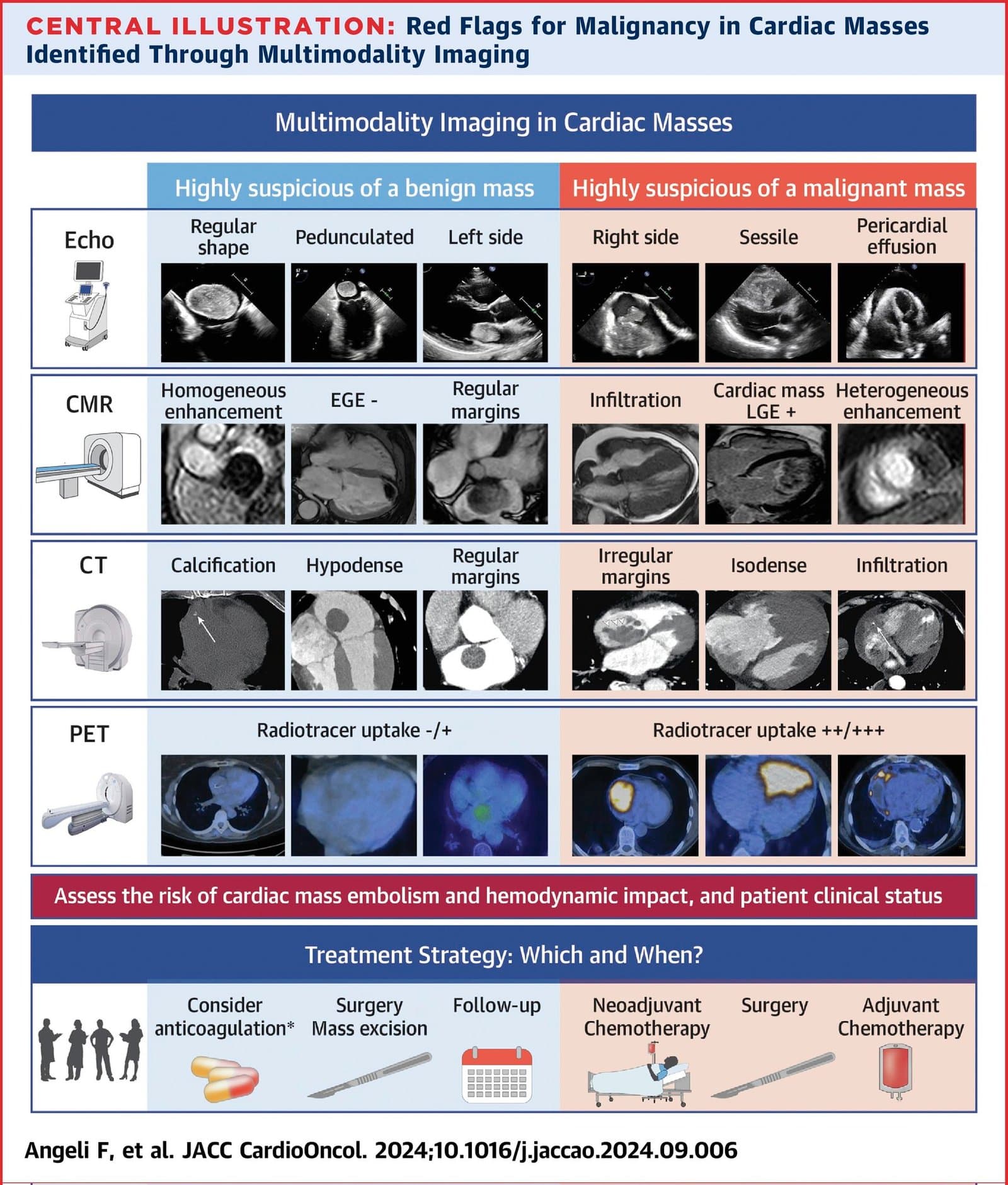 Multimodality Imaging in Cardiac Masses