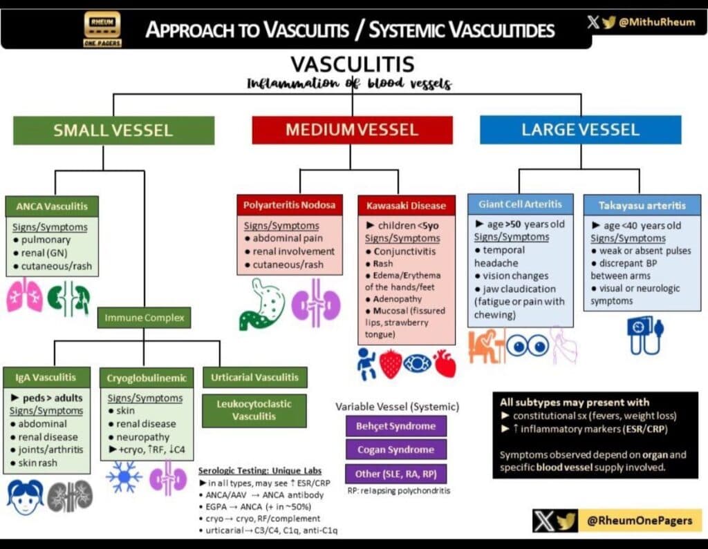 Vasculitis