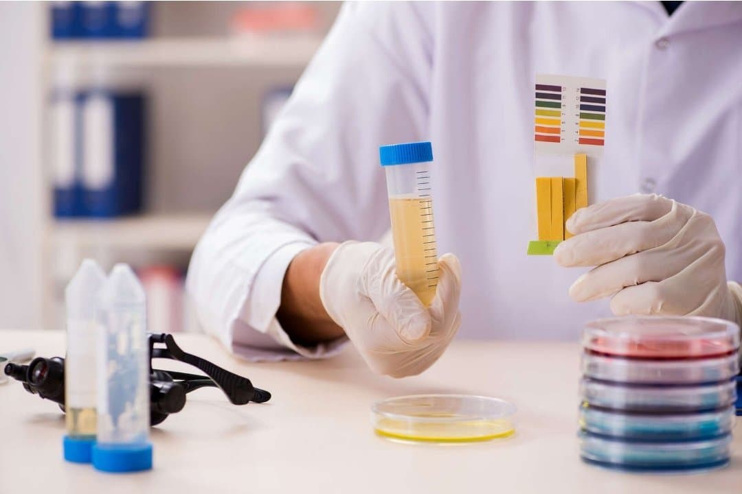 Urine Test May Reveal 4x Risk of Cardiovascular Death in Type 2 Diabetes Patients