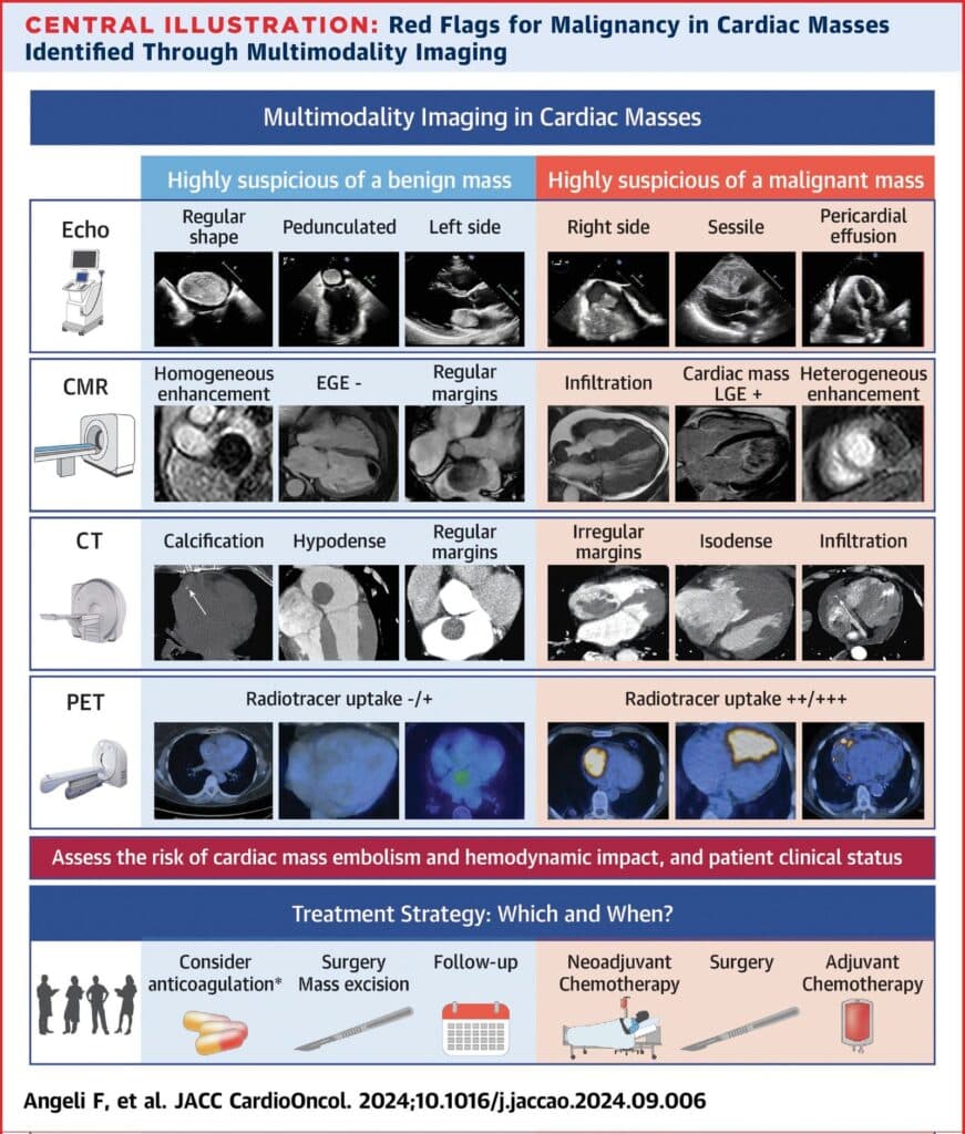 Multimodality Imaging in Cardiac Masses